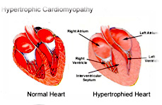 Hipertrofična kardiomiopatija mačaka (HCM)