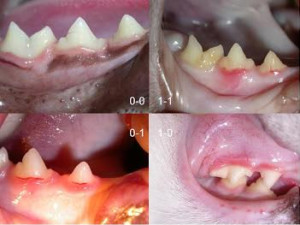Važnost higijene zuba i usne šupljine