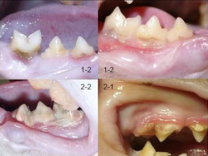 Važnost higijene zuba i usne šupljine
